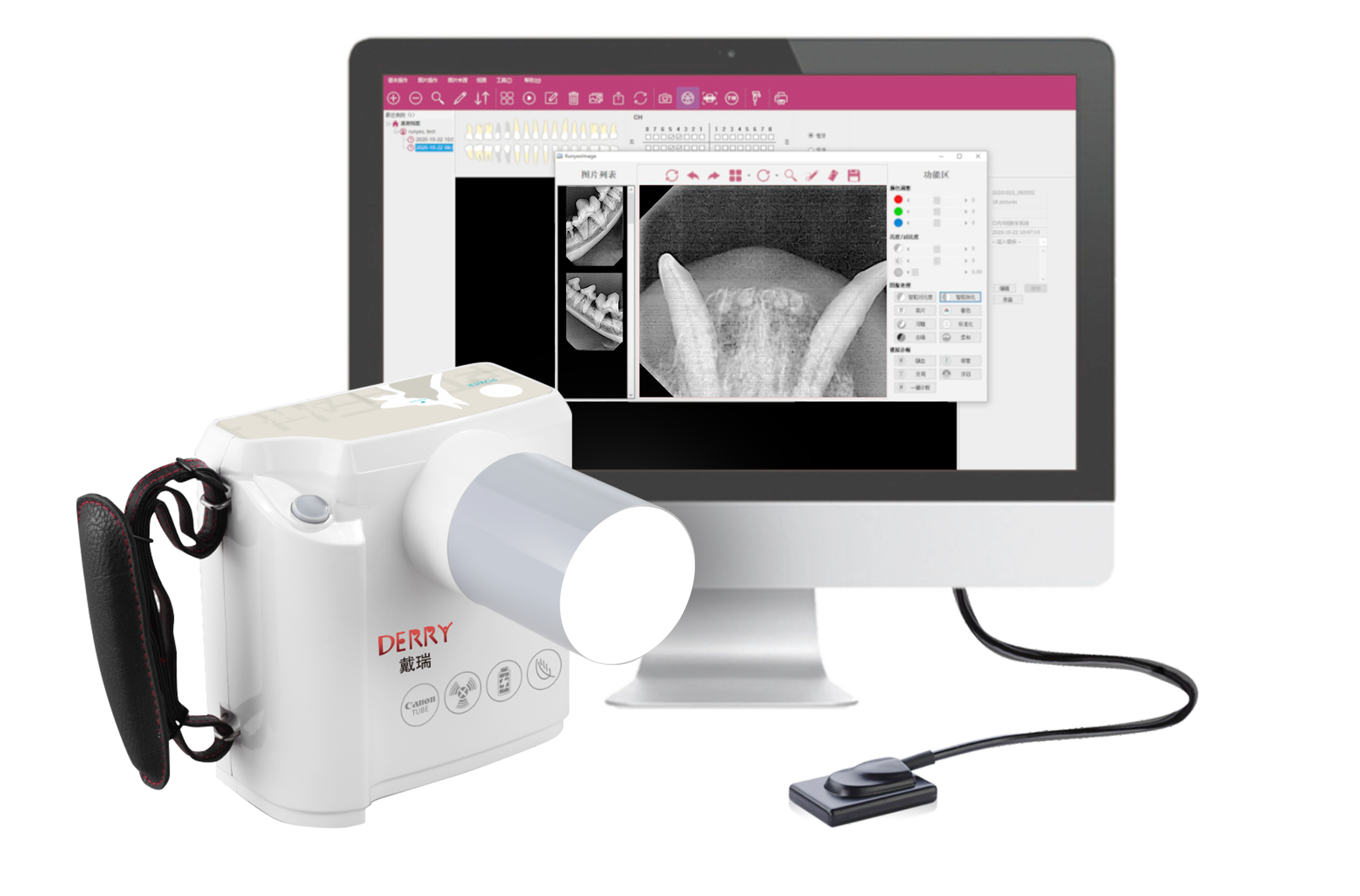 Sistem Pencitraan Sinar-X Gigi Digital Veteriner DR730
